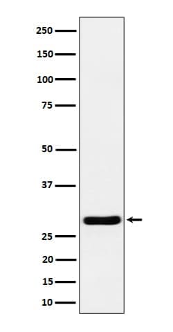 RCAN1 Antibody (SR1461), Novus Biologicals 100 &mu;g | Buy Online | Novus Biologicals | Fisher Scientific