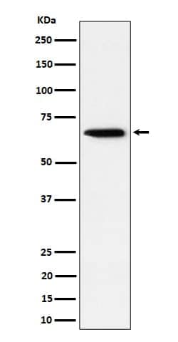 Sterol carrier protein 2 Antibody (SR2036), Novus Biologicals:Anticuerpos:Anticuerpos