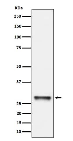 PNMT Antibody (SR1514), Novus Biologicals:Antibodies:Primary Antibodies
