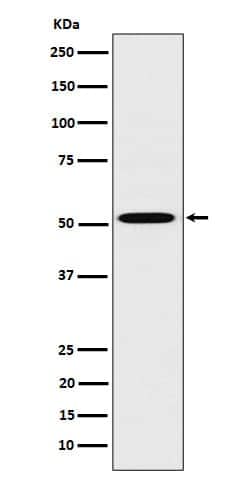 HNF-4 alpha/NR2A1 Antibody (SR1936), Novus Biologicals:Antibodies:Primary