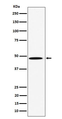 PHD4/HIF Prolyl Hydroxylase 4 Antibody (SR1816), Novus Biologicals:Antibodies:Primary