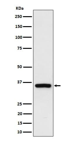 Rad51D Antibody (SR1590), Novus Biologicals 100 &mu;g; Unconjugated:Antibodies,