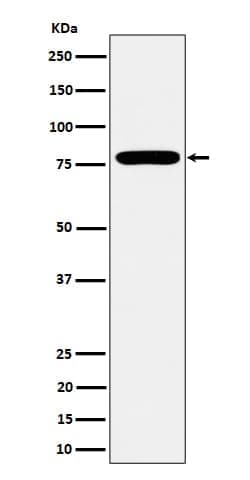 GFPT1 Antibody (SR2221), Novus Biologicals 50 &mu;g; Unconjugated:Antibodies,