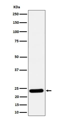 RAB5C Antibody (SR1405), Novus Biologicals 100 &mu;g; Unconjugated:Antibodies,