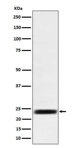ARFRP1 Antibody (SR1362), Novus Biologicals:Antibodies:Primary Antibodies