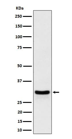 FRAT1 Antibody (SR1483), Novus Biologicals:Antibodies:Primary Antibodies