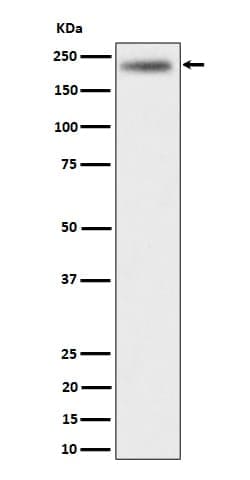 MADD Antibody (SR1358), Novus Biologicals 50 &mu;g; Unconjugated:Antibodies,