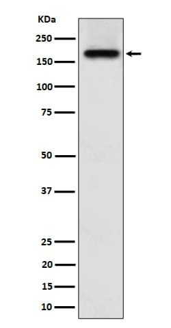 ZFYVE9 Antibody (SR1275), Novus Biologicals:Antibodies:Primary Antibodies