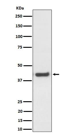 MVK Antibody (SR1713), Novus Biologicals 100 &mu;g; Unconjugated:Antibodies,