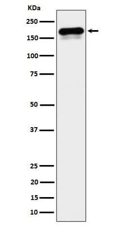 CLIP170 Antibody (SR1120), Novus Biologicals 50 &mu;g; Unconjugated:Antibodies,