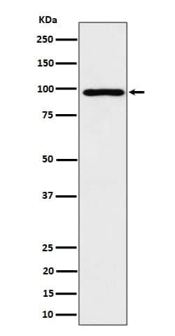 AKAP95/AKAP8 Antibody (SR2296), Novus Biologicals 100 &mu;g | Buy Online | Novus Biologicals | Fisher Scientific