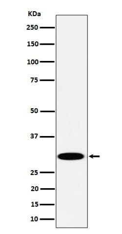 TPMT Antibody (SR1518), Novus Biologicals 100 &mu;g; Unconjugated:Antibodies,