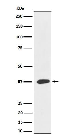MAS1L Antibody (SR1619), Novus Biologicals 100 &mu;g; Unconjugated:Antibodies,