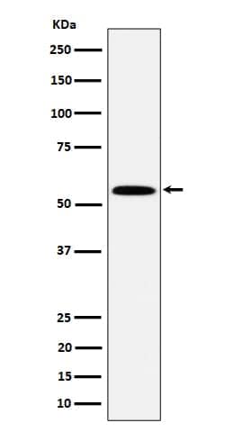 PNK Antibody (SR2020), Novus Biologicals:Antibodies:Primary Antibodies