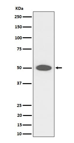 FGFR1OP Antibody (SR1871), Novus Biologicals:Antibodies:Primary Antibodies
