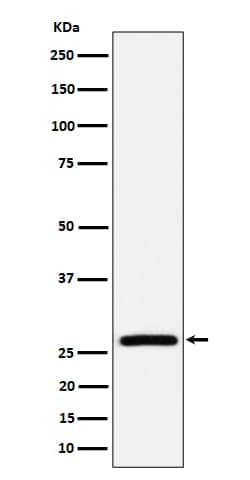 AK2 Antibody (SR1416), Novus Biologicals 50 &mu;g; Unconjugated:Antibodies,