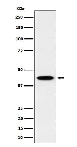 ITPK1 Antibody (SR1711), Novus Biologicals 50 &mu;g; Unconjugated:Antibodies,