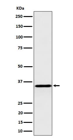 Inorganic Pyrophosphatase/PPA1 Antibody (SR1552), Novus Biologicals:Antibodies:Primary