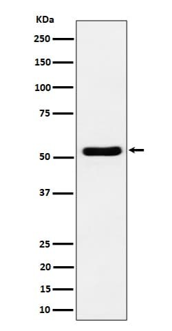 GPRC5B Antibody (SR1918), Novus Biologicals:Antibodies:Primary Antibodies