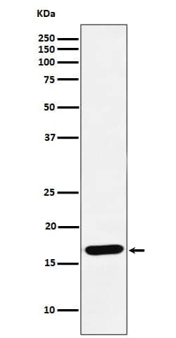 UbcH5a/UBE2D1 Antibody (SR1267), Novus Biologicals:Antibodies:Primary Antibodies