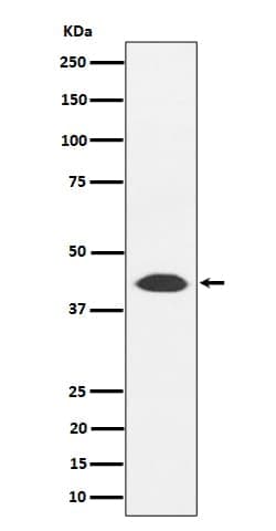 NUDT19 Antibody (SR1715), Novus Biologicals 100 &mu;g, Unconjugated:Antibodies,