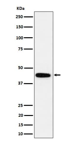 GALT Antibody (SR1733), Novus Biologicals:Antibodies:Primary Antibodies