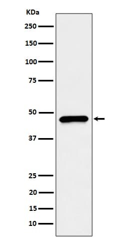 CECR5 Antibody (SR1791), Novus Biologicals:Antibodies:Primary Antibodies