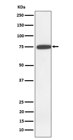 N-Acetylmannosamine Kinase/GNE Antibody (SR2196), Novus Biologicals:Antibodies:Primary