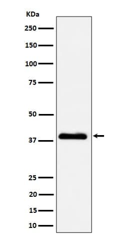 NSDHL Antibody (SR1643), Novus Biologicals 50 &mu;g | Buy Online | Novus Biologicals | Fisher Scientific