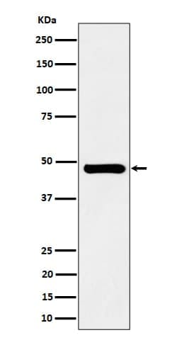 SNX5 Antibody (SR1821), Novus Biologicals:Antibodies:Primary Antibodies