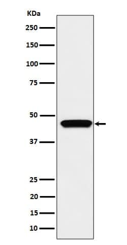 MAPKAP Kinase 3 Antibody (SR1737), Novus Biologicals 100 &mu;g; Unconjugated:Antibodies,