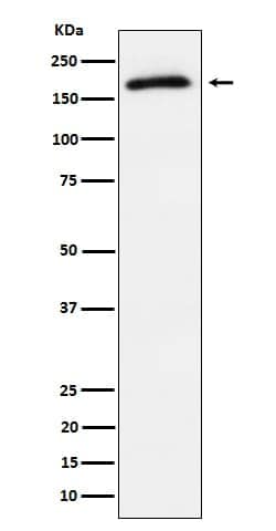 TBC1D4, p Thr642 Antibody (SR1272), Novus Biologicals 50 &mu;g; Unconjugated:Antibodies,