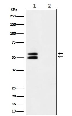 CaM Kinase II alpha, p Thr286 Antibody (SR1853), Novus Biologicals 100