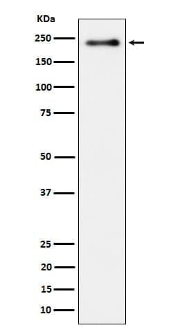 LRP-6, p Ser1490 Antibody (SR1321), Novus Biologicals 100 &mu;g; Unconjugated:Antibodies,