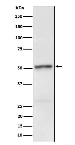 RIPK3/RIP3, p Ser232 Antibody (SR1864), Novus Biologicals 100 &mu;g; Unconjugated:Antibodies,