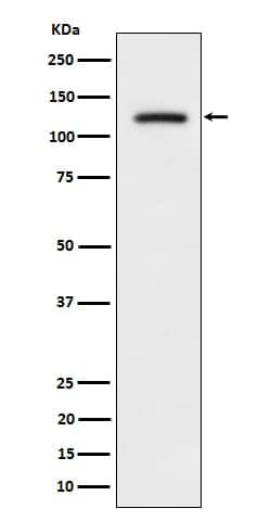 ULK1, p Ser556 Antibody (SR1119), Novus Biologicals 100 &mu;g; Unconjugated:Antibodies,
