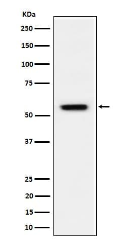 Vimentin, p Ser39 Antibody (SR1953), Novus Biologicals:Antibodies:Primary