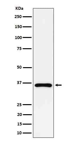 GAS2 Antibody (SR1577), Novus Biologicals 50 &mu;g; Unconjugated:Antibodies,