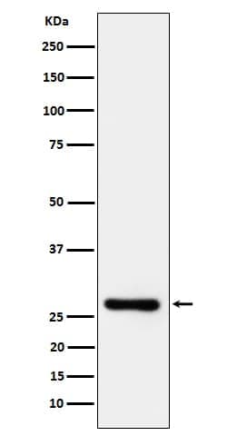 TRAILR3/TNFRSF10C Antibody (SR1429), Novus Biologicals 100 &mu;g | Buy Online | Novus Biologicals | Fisher Scientific
