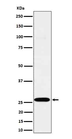 Complement Component C1qA Antibody (SR1502), Novus Biologicals 50 &mu;g;