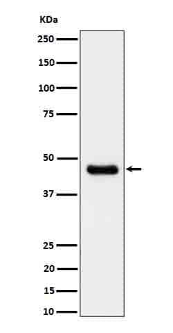 CABP1 Antibody (SR1754), Novus Biologicals:Antibodies:Primary Antibodies