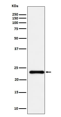 UBE2T Antibody (SR1361), Novus Biologicals:Antibodies:Primary Antibodies