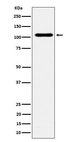 EXOC2 Antibody (SR1032), Novus Biologicals:Antibodies:Primary Antibodies