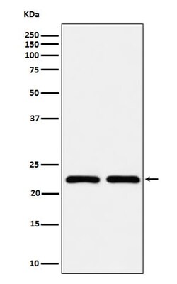 RAB22A Antibody (SR1340), Novus Biologicals:Antibodies:Primary Antibodies