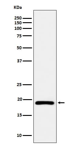 dUTPase Antibody (SR1280), Novus Biologicals 50 &mu;g; Unconjugated:Antibodies,