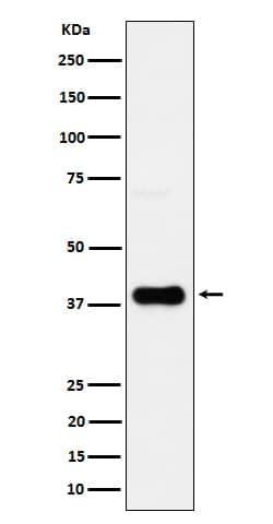 CXCR6 Antibody (SR1646), Novus Biologicals:Antibodies:Primary Antibodies