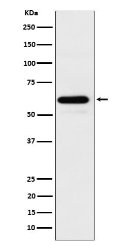 CDC73/HRPT2 Antibody (SR2070), Novus Biologicals 100 &mu;g; Unconjugated:Antibodies,