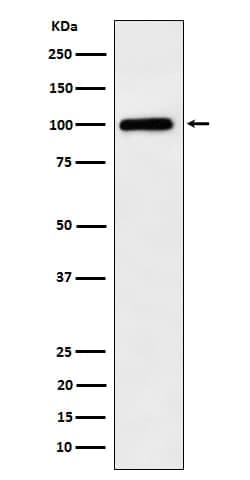 Desmocollin-1 Antibody (SR1004), Novus Biologicals 50 &mu;g; Unconjugated:Antibodies,