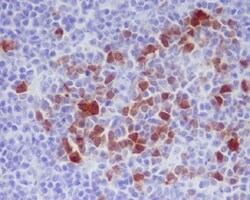 CDK1/2, p Thr14 Antibody (SR1565), Novus Biologicals:Antibodies:Primary