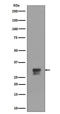 CDK1/2, p Thr14 Antibody (SR1565), Novus Biologicals:Antibodies:Primary